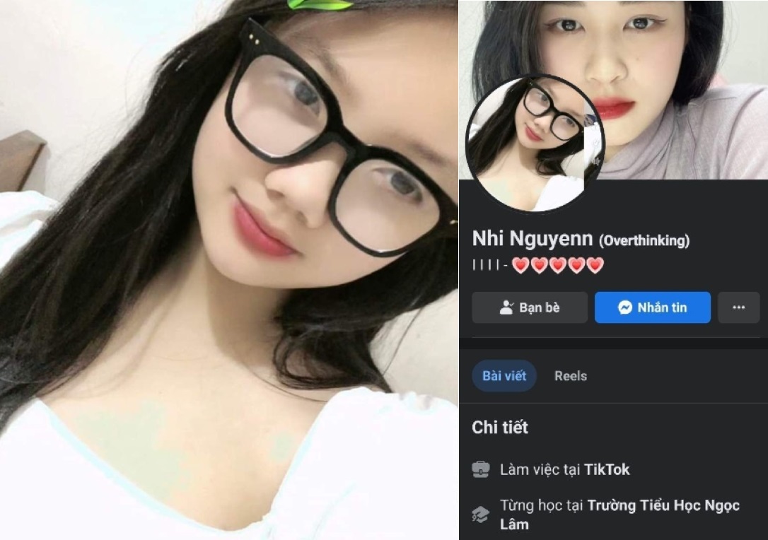 nhi-nguyen-hap-dan-da-bi-thuong-nang
